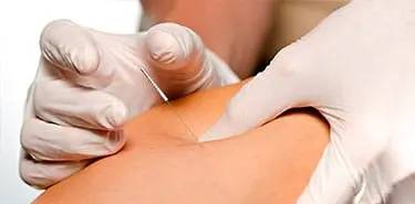 clínica-de-fisioterapia-tratamiento-de-punción-seca
